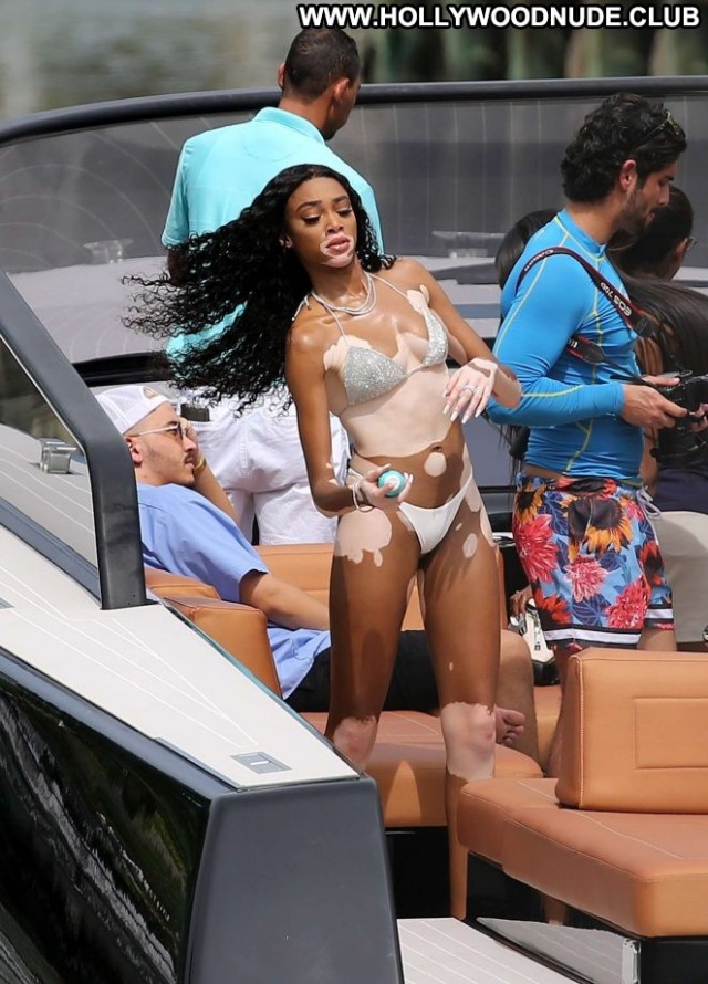 Winnie Harlow No Source Bikini Celebrity Posing Hot Beautiful